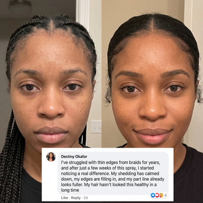 Rosemary + Rice Water Extract