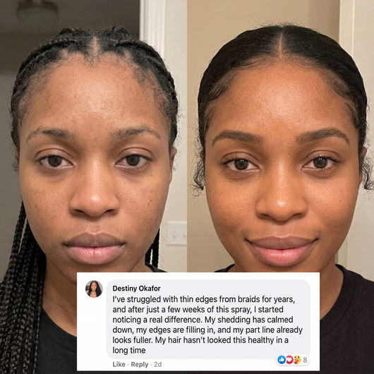 Rosemary + Rice Water Extract